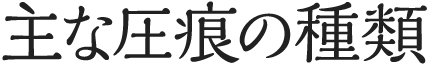 主な圧痕の種類